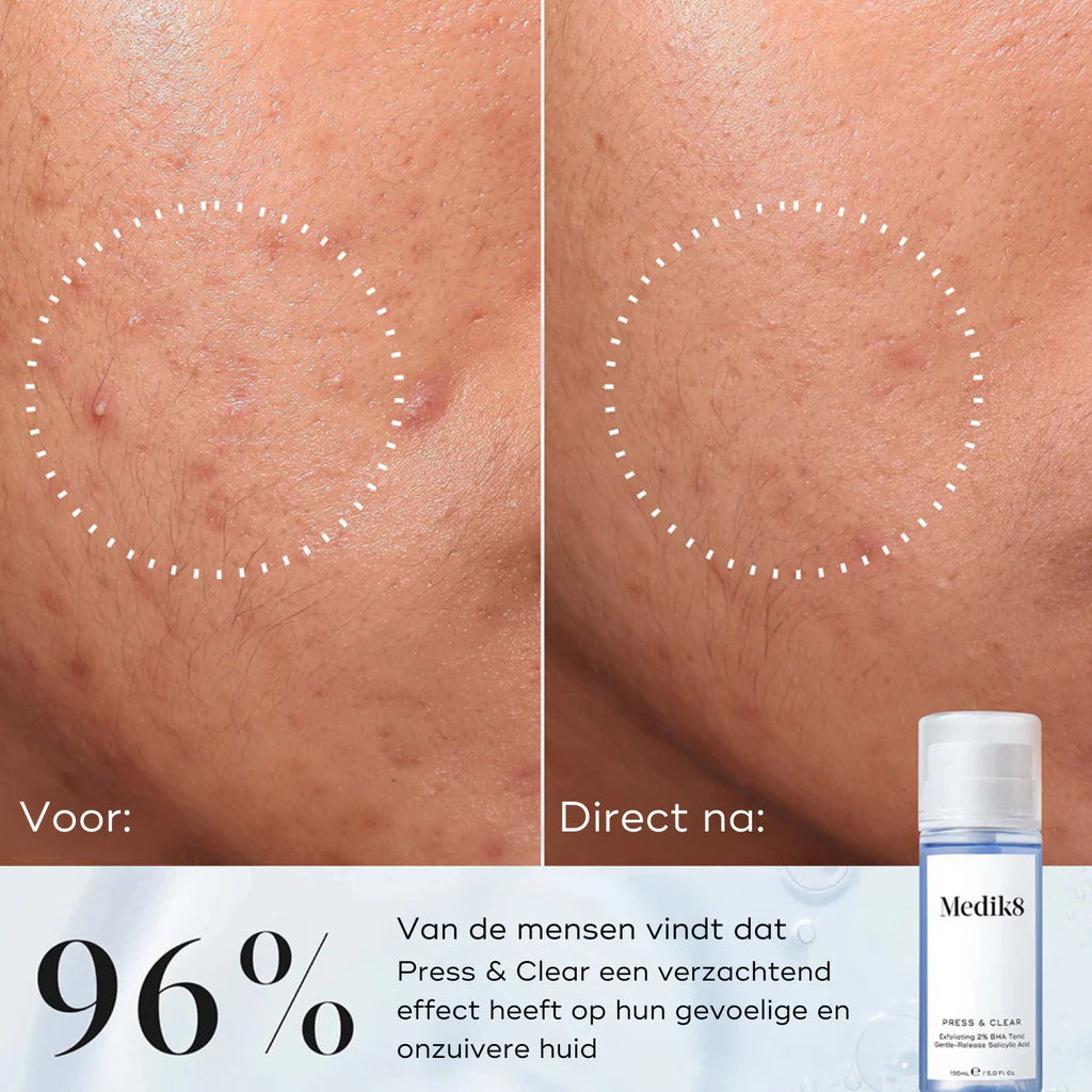 Press & Clear Toner