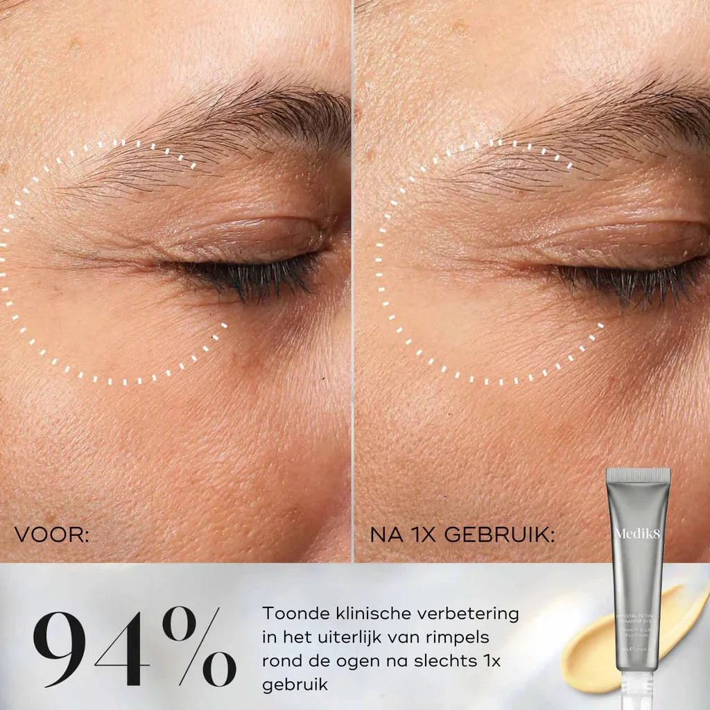 Crystal Retinal Ceramide Eye 3