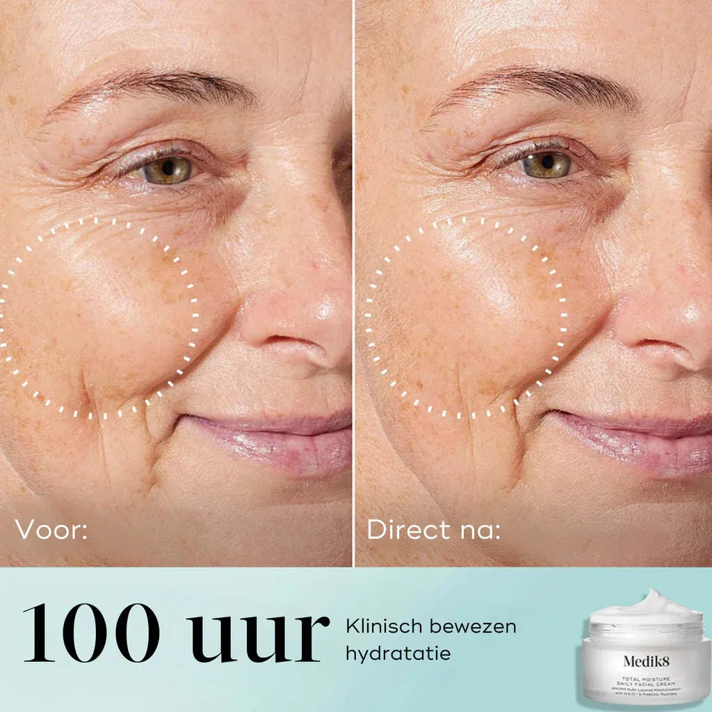 Total Moisture Daily Facial Cream™
