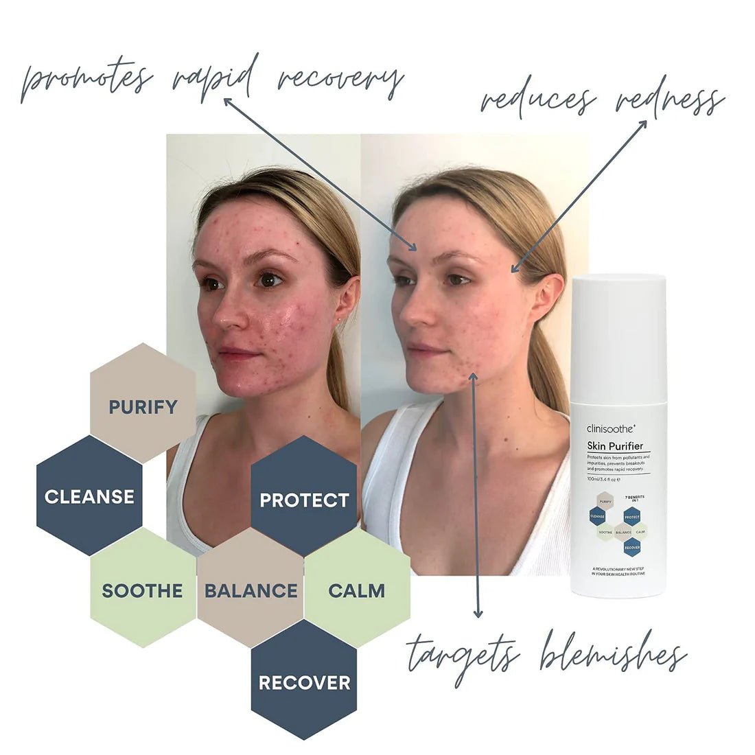 Clinisoothe+ Skin Purifier